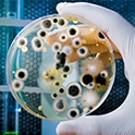 petri dish