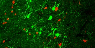 Mouse brain with stress molecule