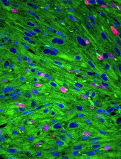 heart cells
