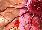 cancer cells