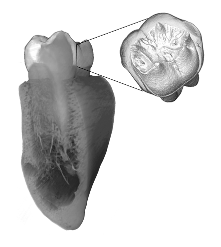 image of tooth in it's socket